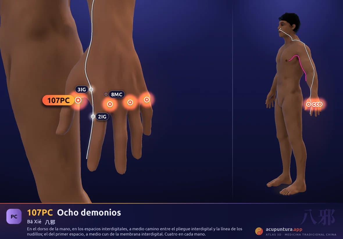 Localización del punto 107PC, Ocho demonios