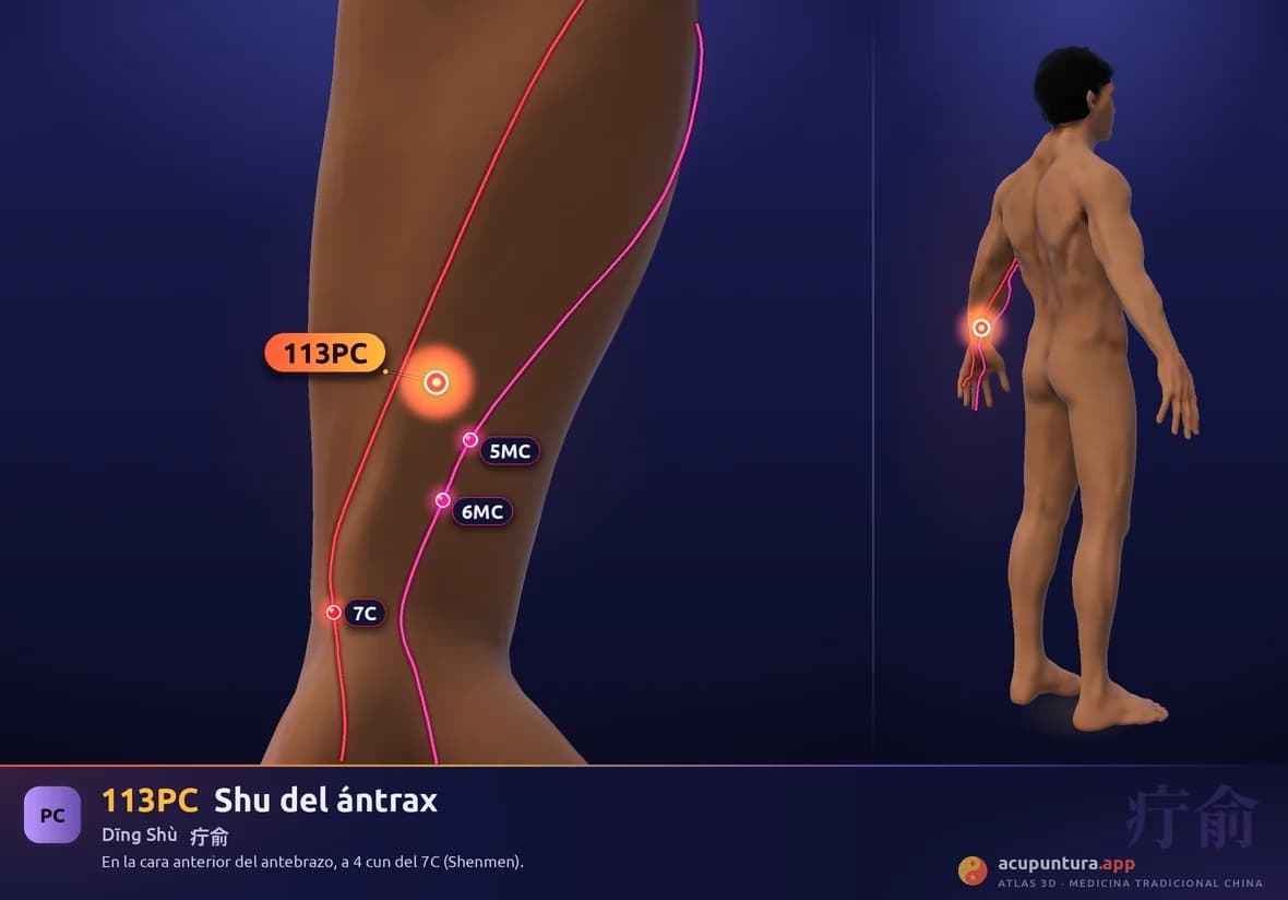 Localización del punto 113PC, Shu del ántrax