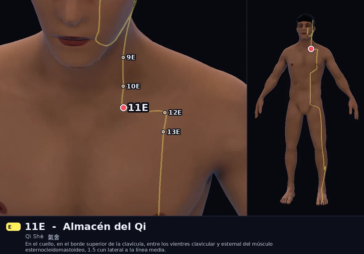 Localización del punto 11E, Almacén del Qi