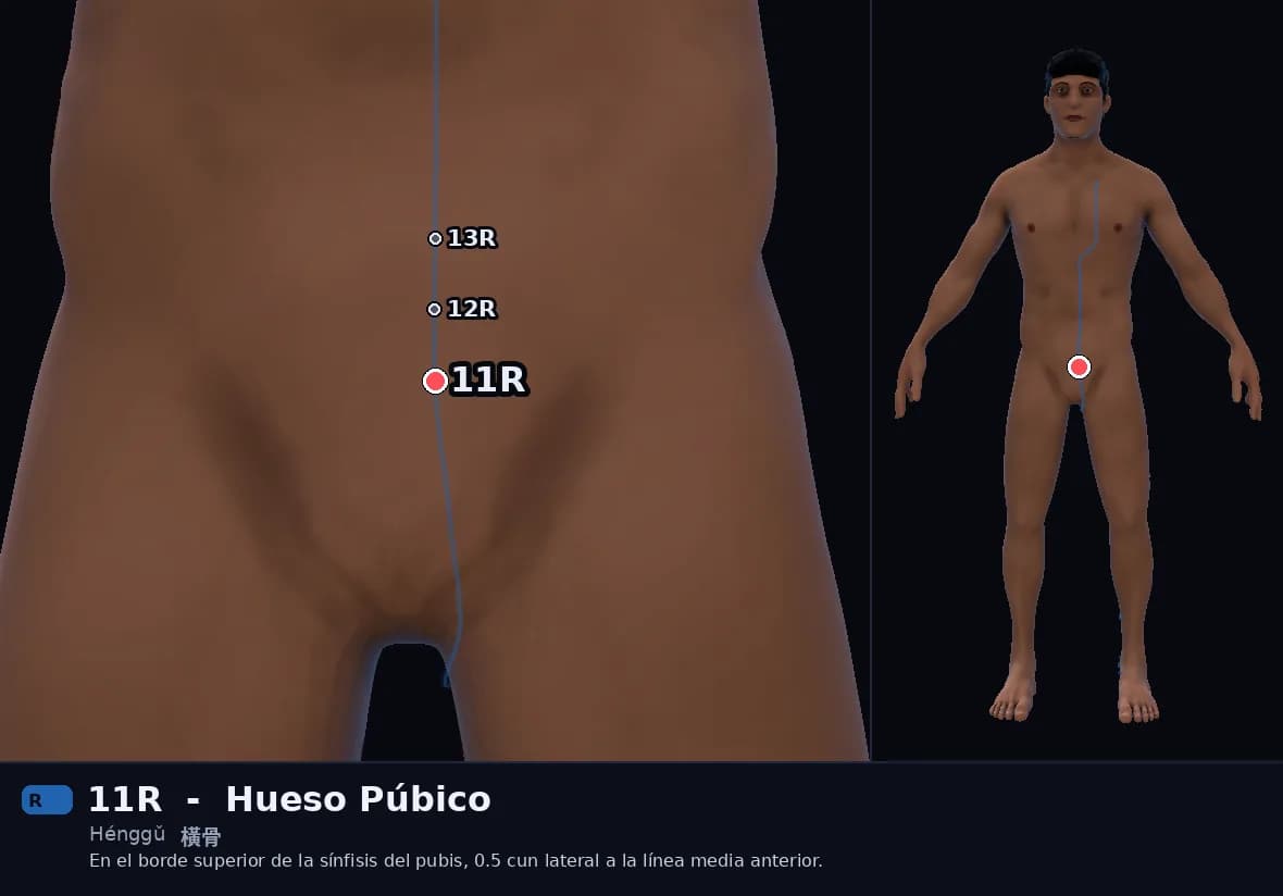 Localización del punto 11R, Hueso Púbico