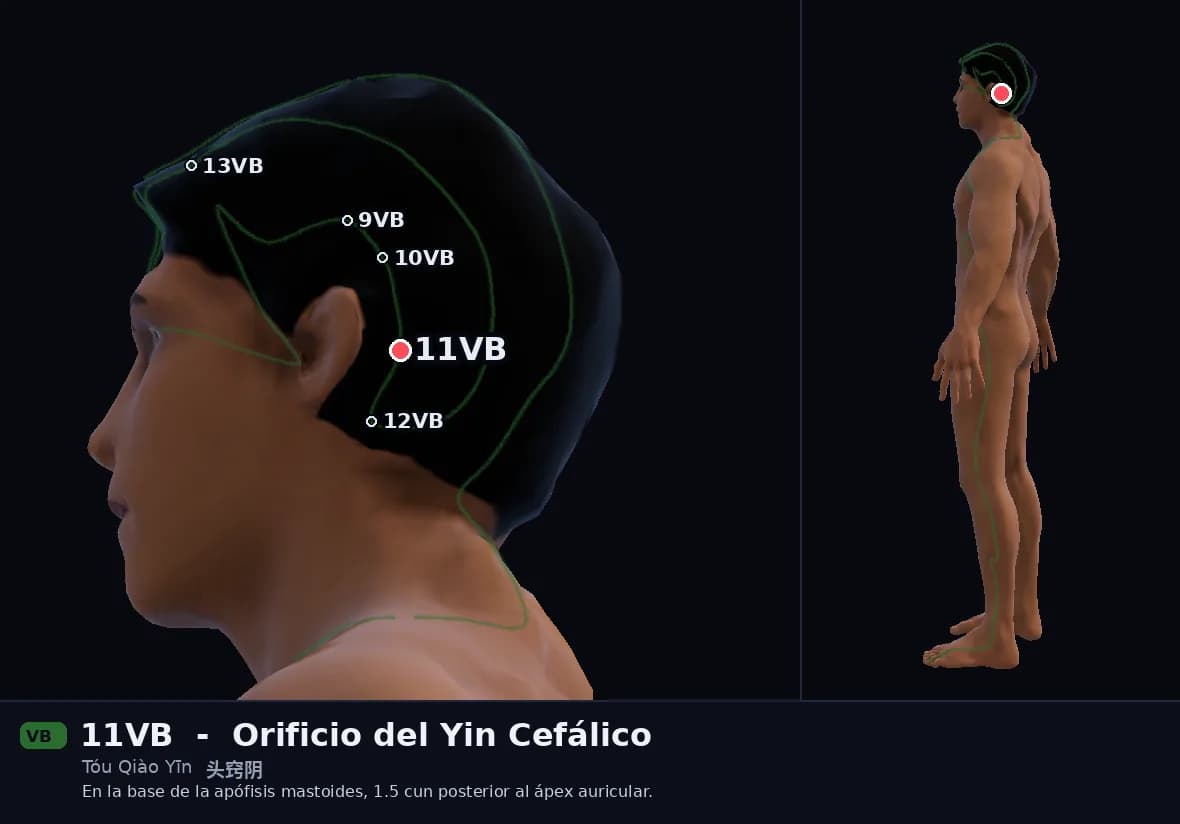 Localización del punto 11VB, Orificio del Yin Cefálico
