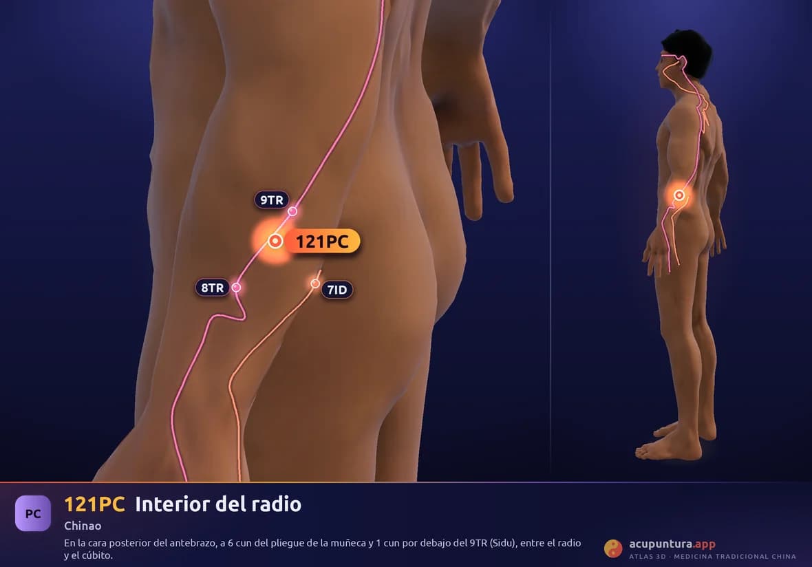 Localización del punto 121PC, Interior del radio