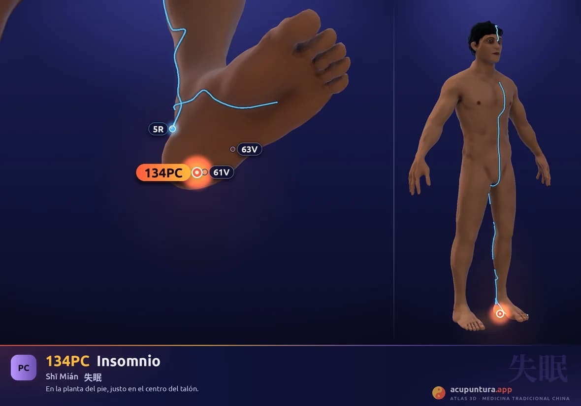 Localización del punto 134PC, Insomnio