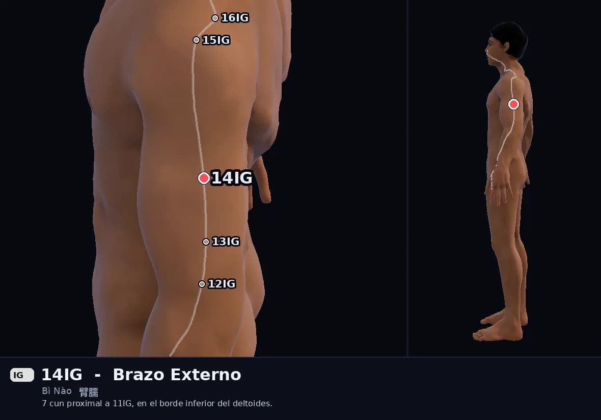 Localización del punto 14IG, Brazo Externo
