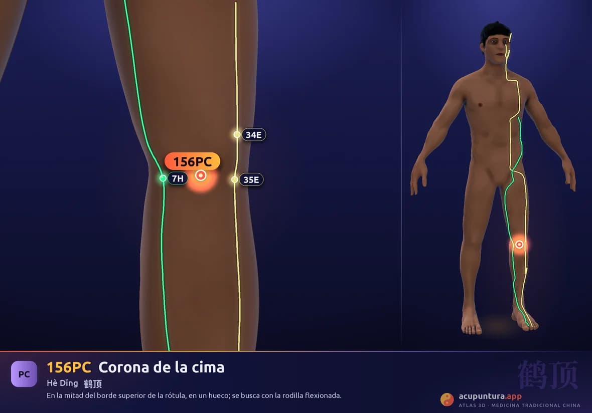 Localización del punto 156PC, Corona de la cima