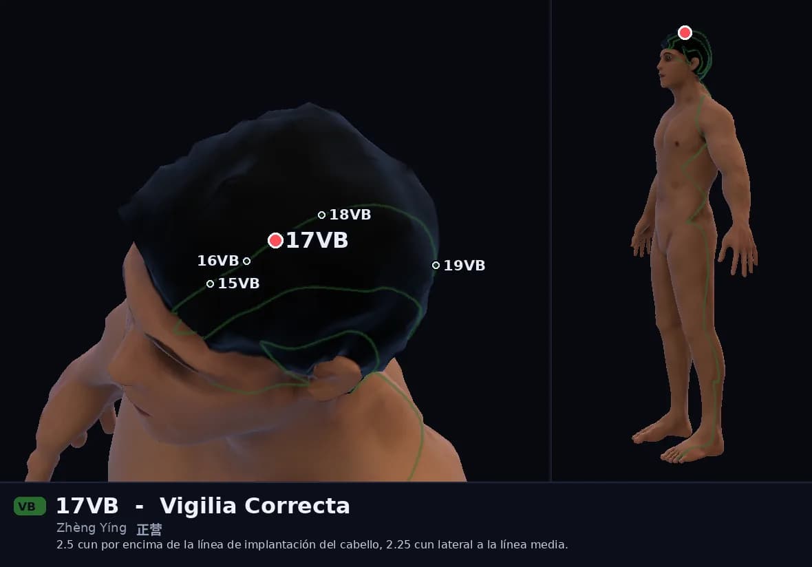 Localización del punto 17VB, Vigilia Correcta
