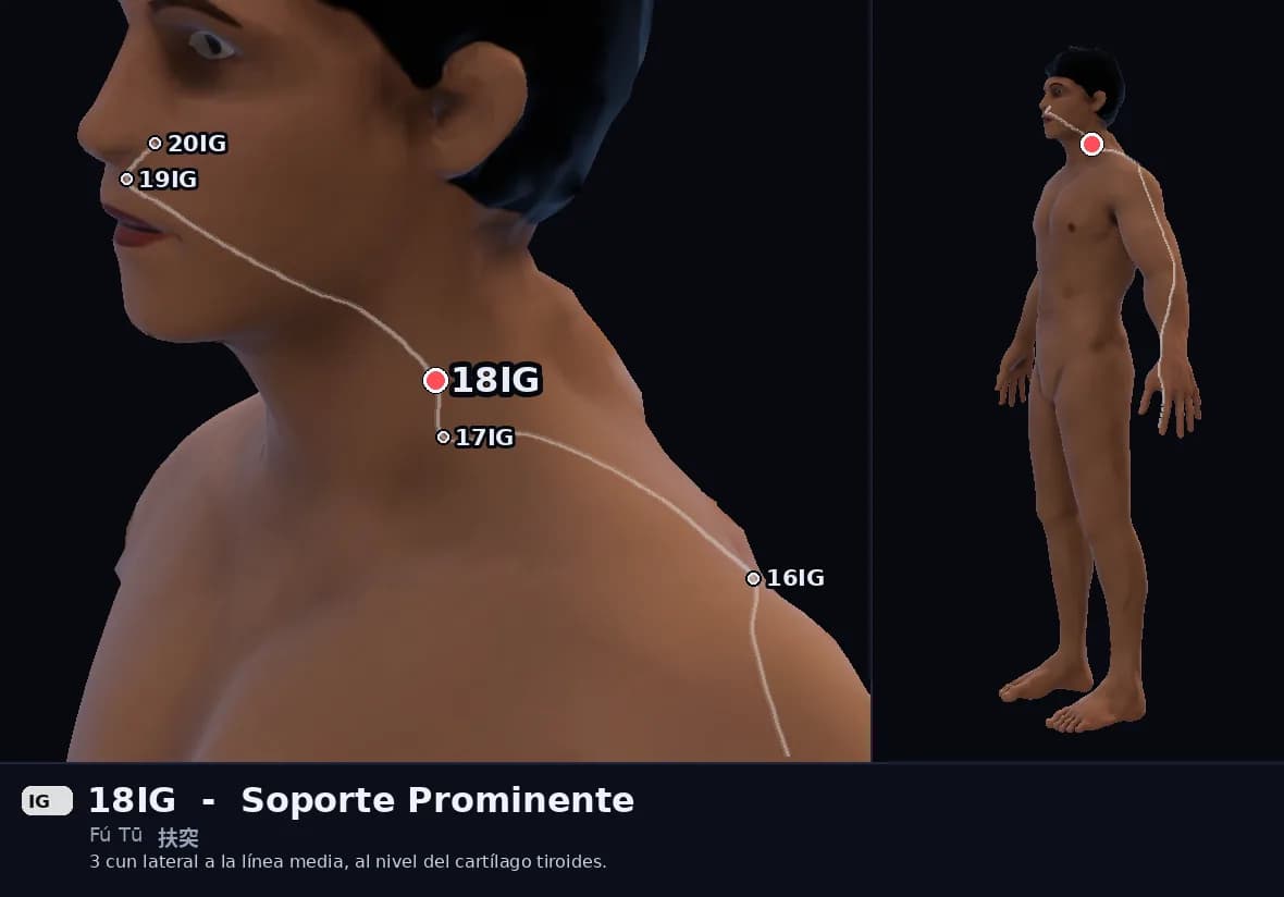 Localización del punto 18IG, Soporte Prominente