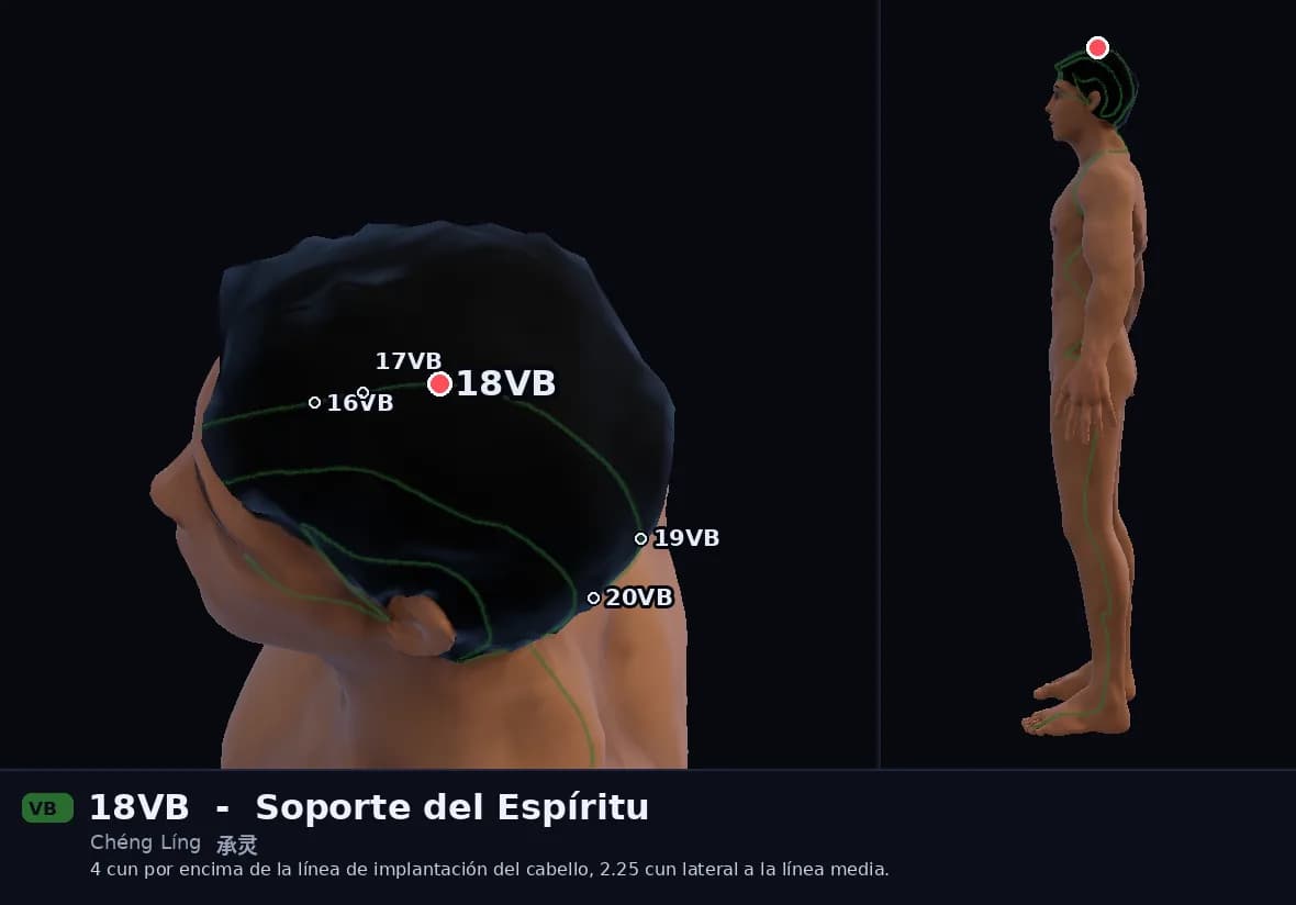Localización del punto 18VB, Soporte del Espíritu