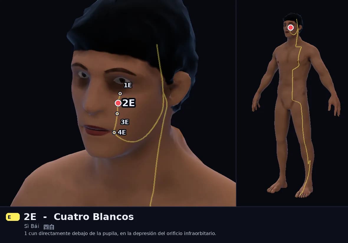 Localización del punto 2E, Cuatro Blancos