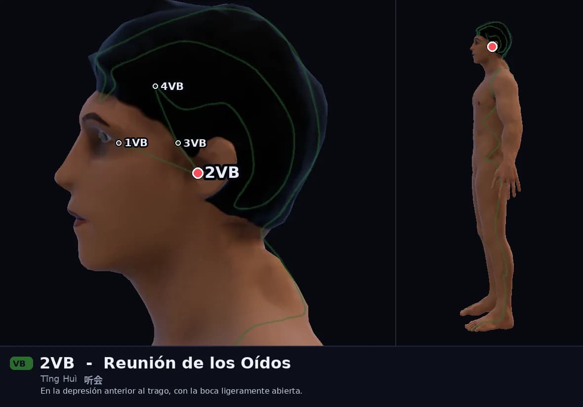 Localización del punto 2VB, Reunión de los Oídos