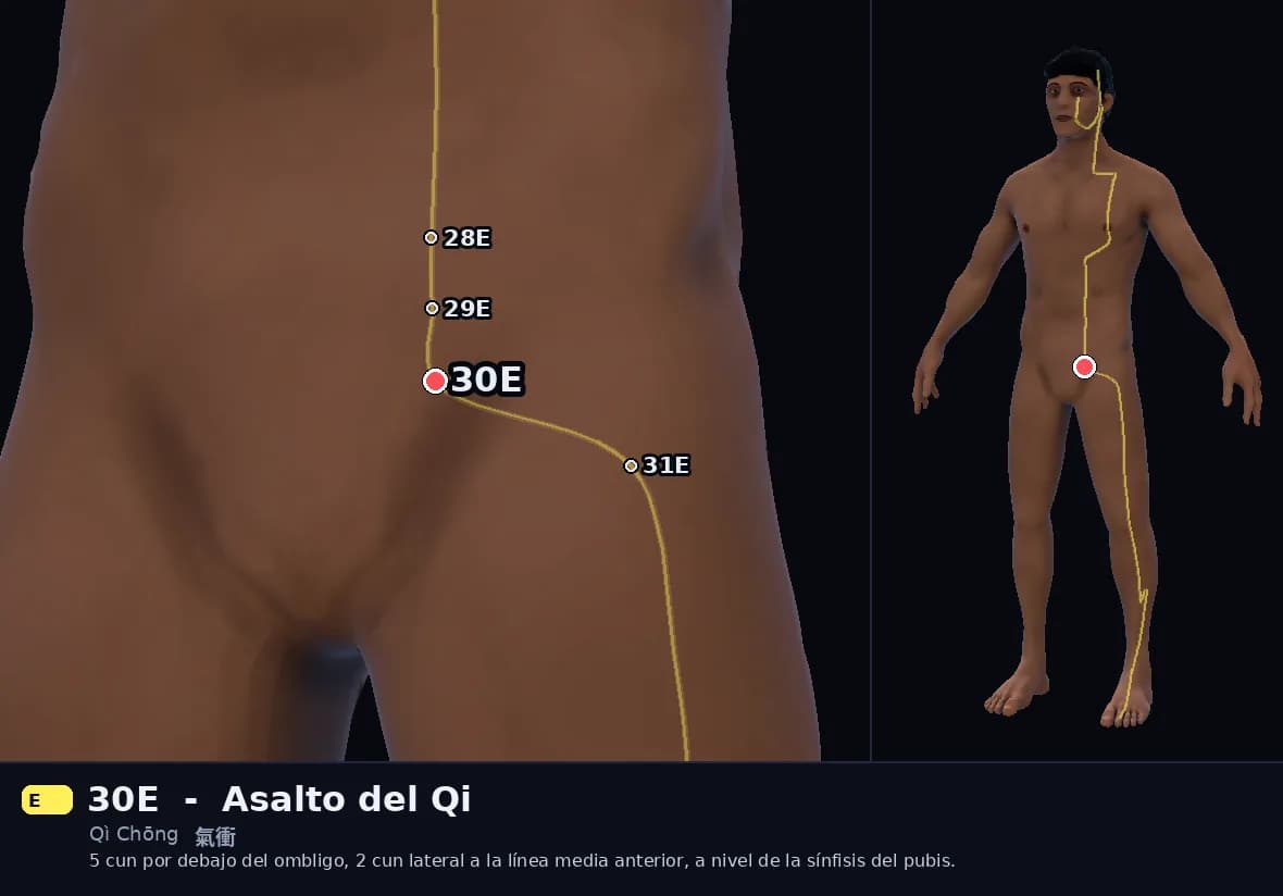 Localización del punto 30E, Asalto del Qi