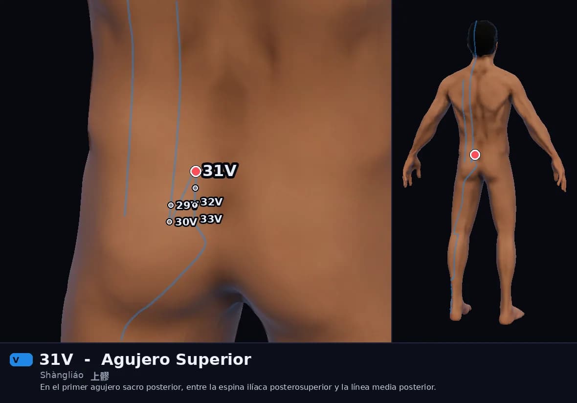 Localización del punto 31V, Agujero Superior