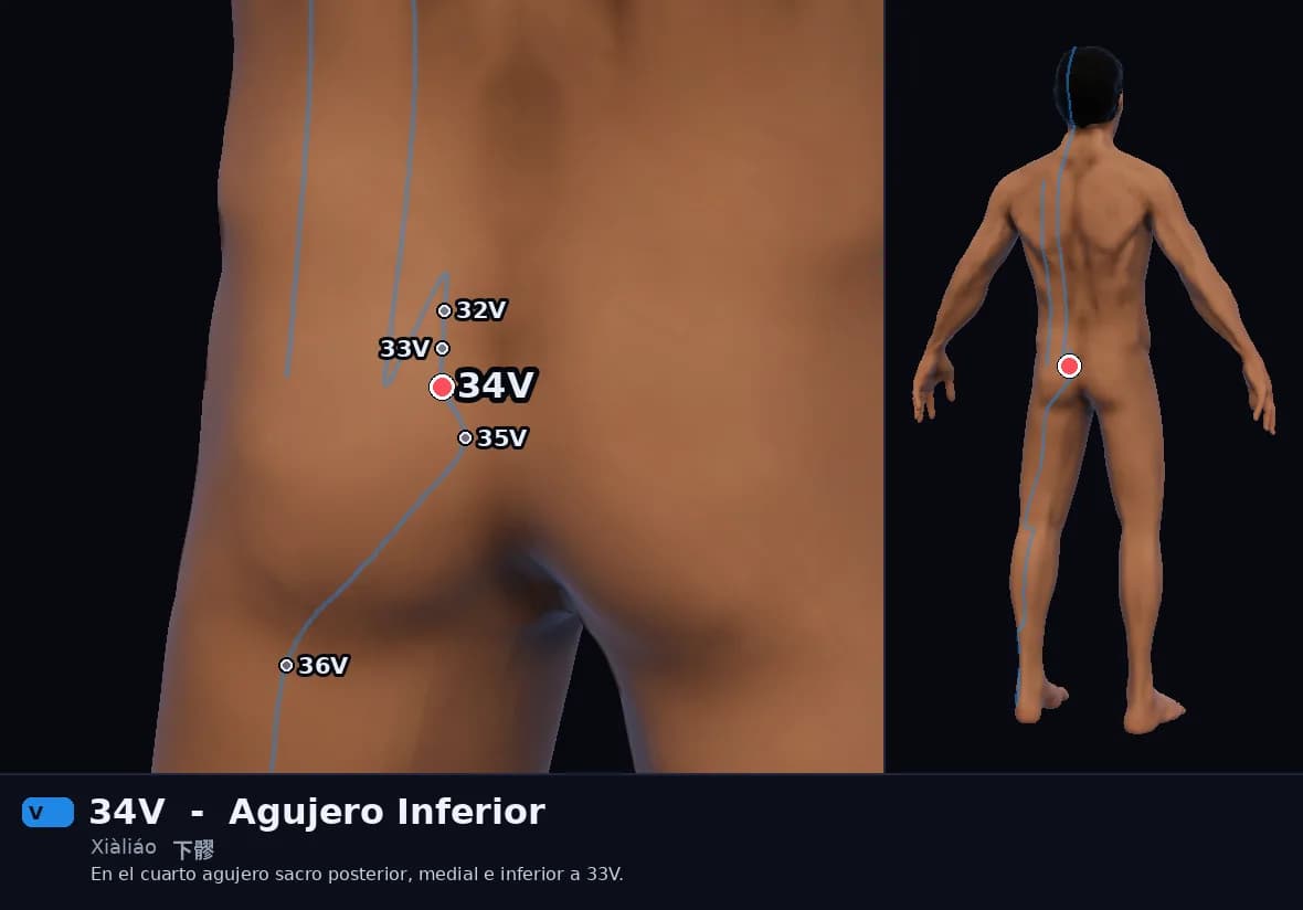 Localización del punto 34V, Agujero Inferior