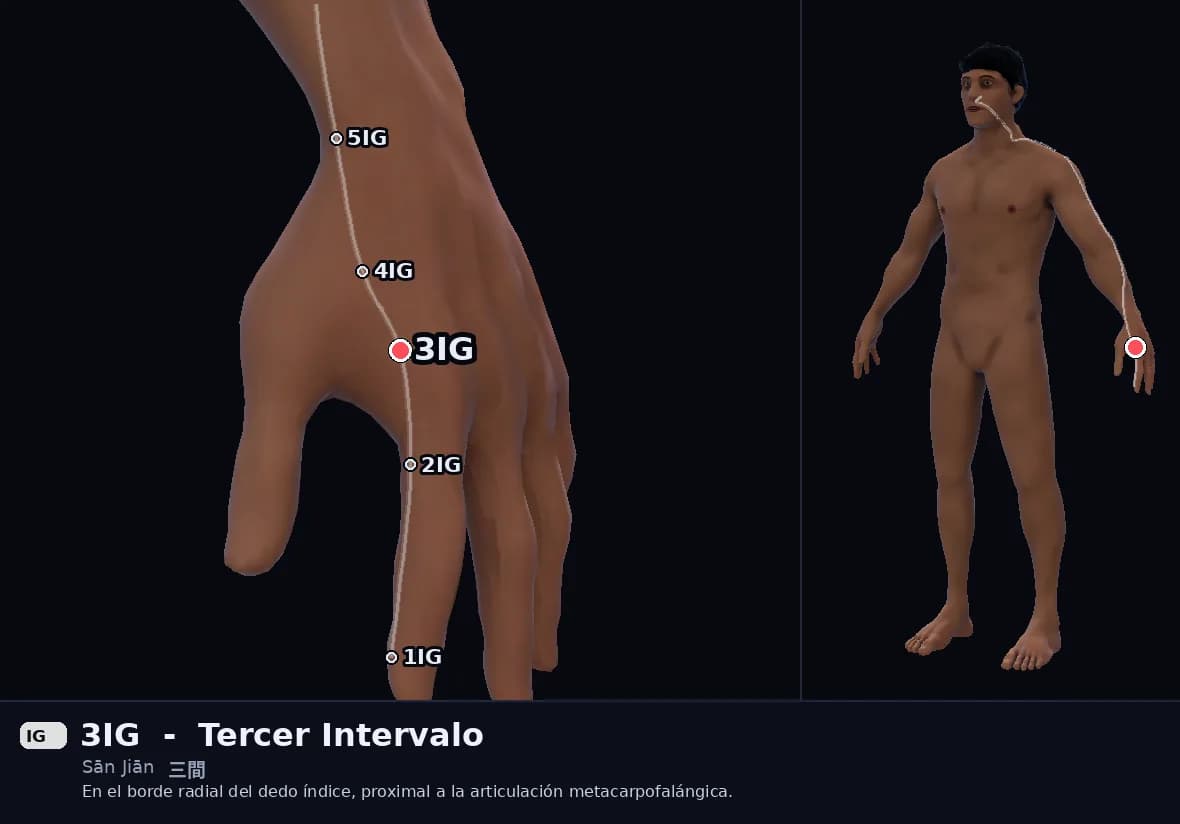 Localización del punto 3IG, Tercer Intervalo
