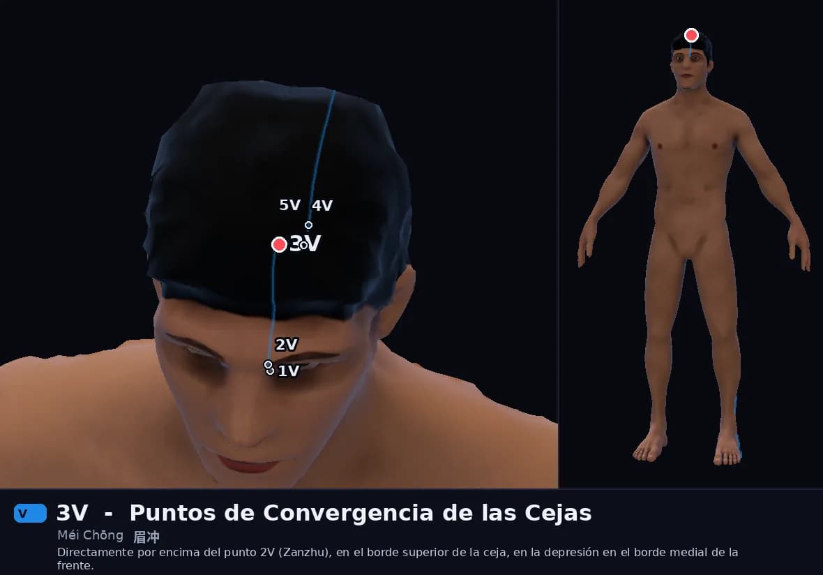 Localización del punto 3V, Asalto de la Ceja