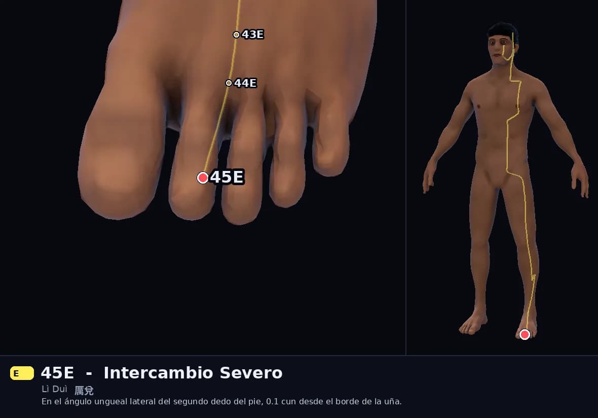 Localización del punto 45E, Intercambio Severo