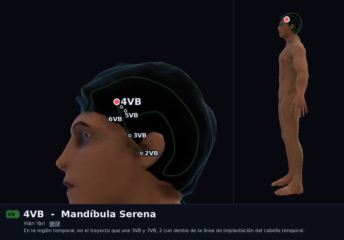 Localización del punto 4VB, Mandíbula Serena