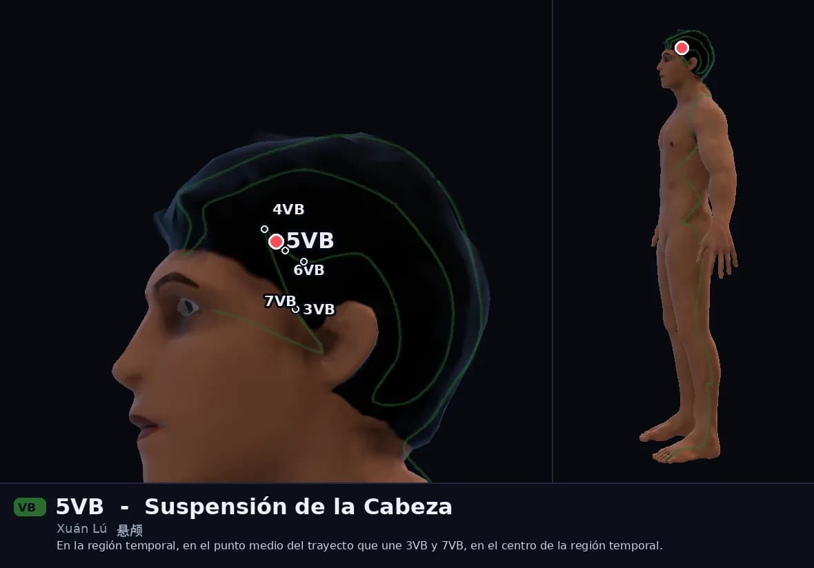 Localización del punto 5VB, Suspensión de la Cabeza