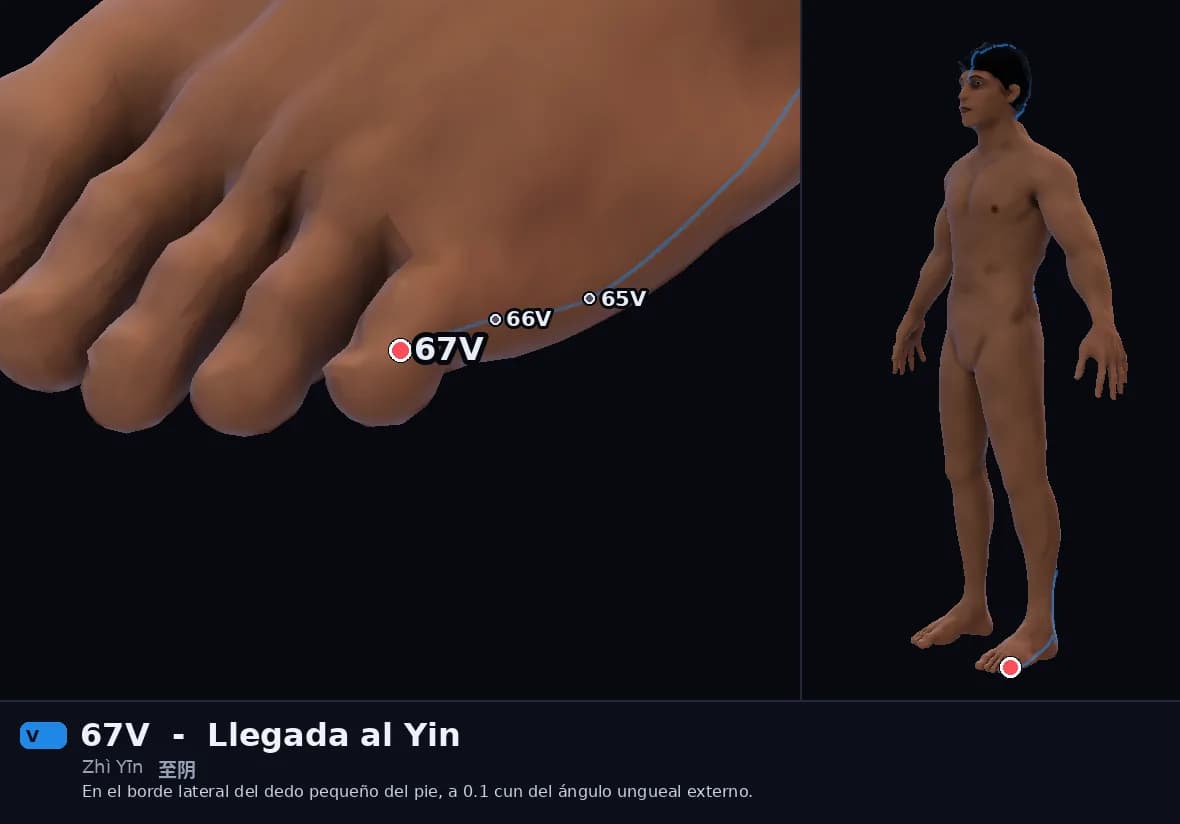 Localización del punto 67V, Llegada al Yin