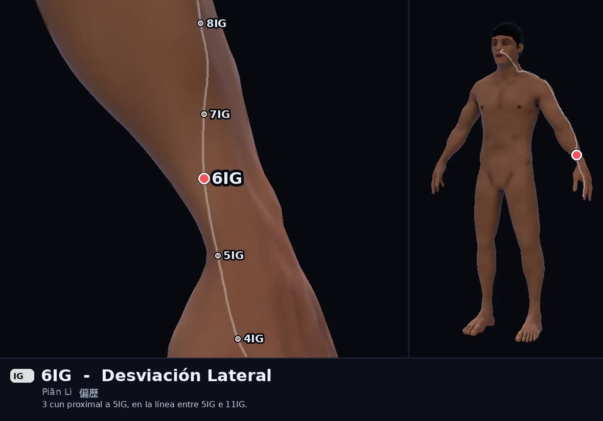 Localización del punto 6IG, Desviación Lateral