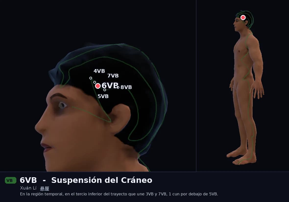 Localización del punto 6VB, Suspensión del Cráneo