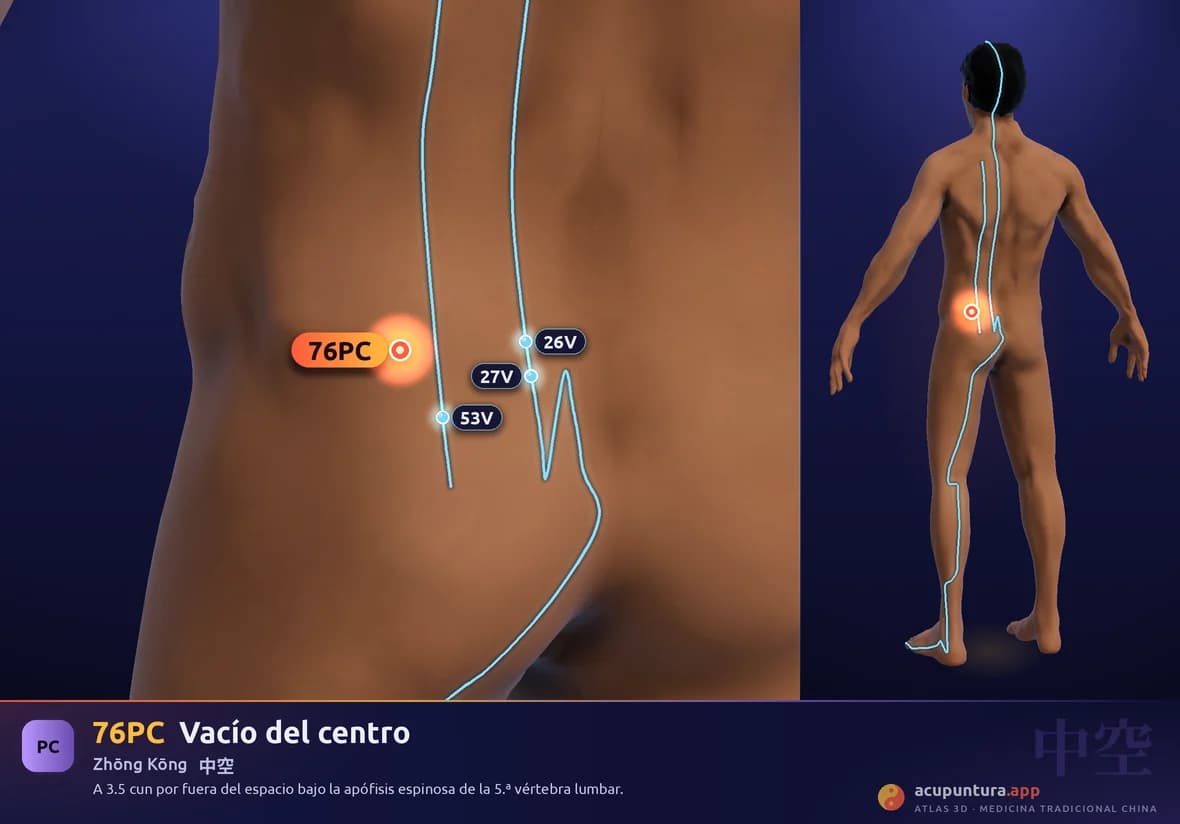 Localización del punto 76PC, Vacío del centro