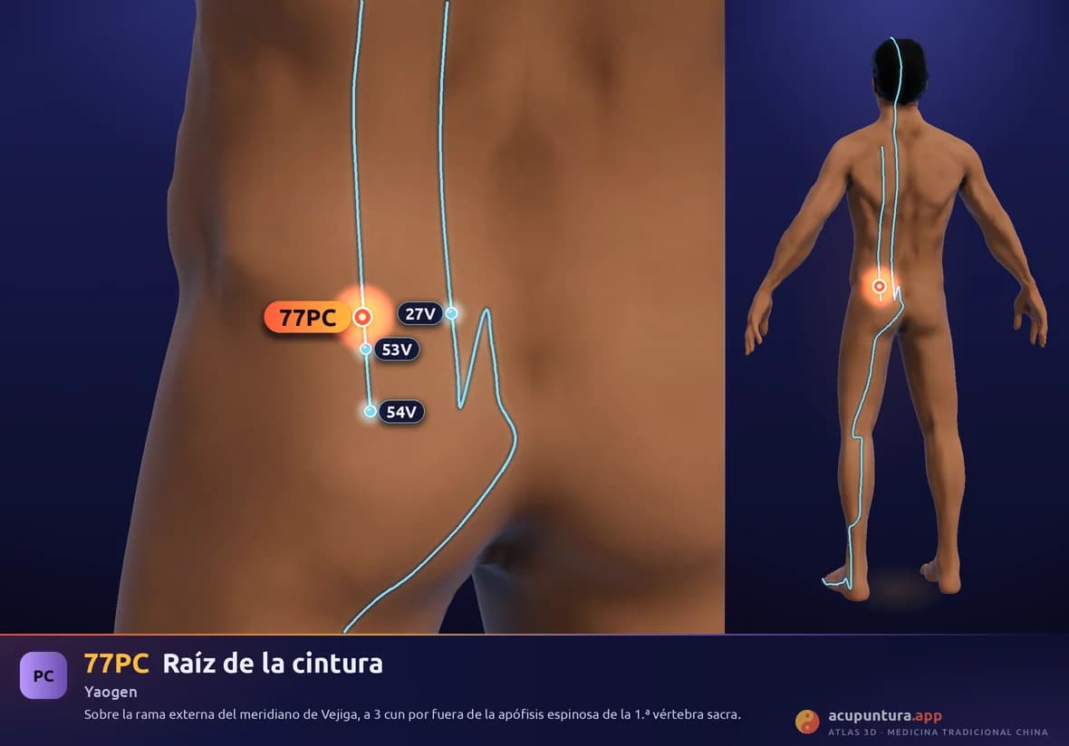 Localización del punto 77PC, Raíz de la cintura