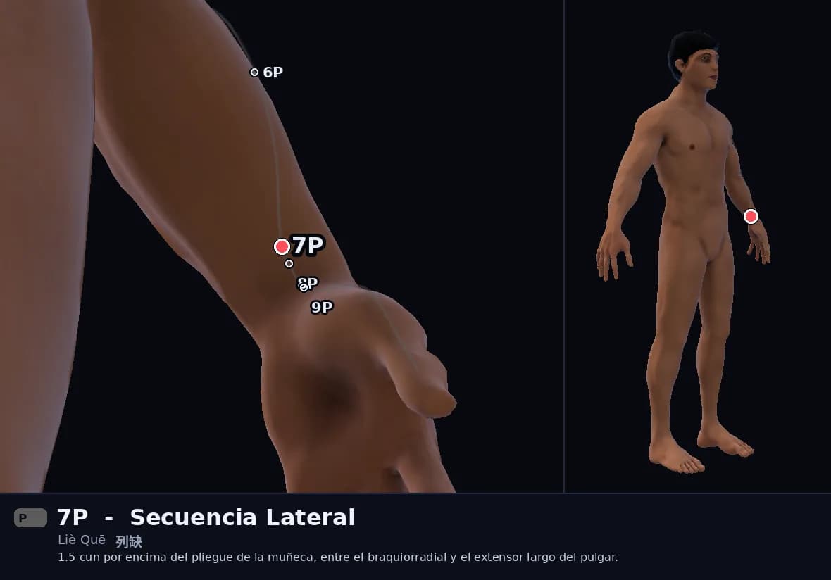 Localización del punto 7P, Secuencia Lateral