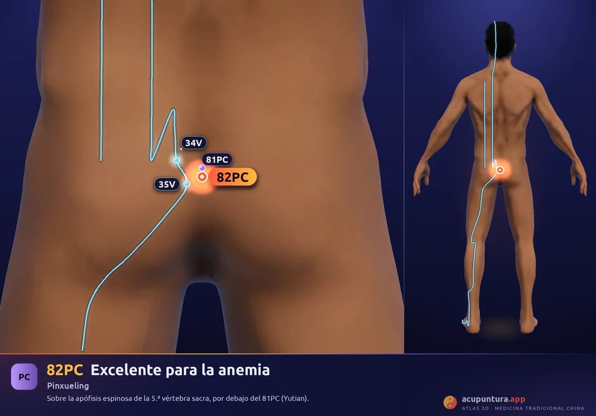 Localización del punto 82PC, Excelente para la anemia