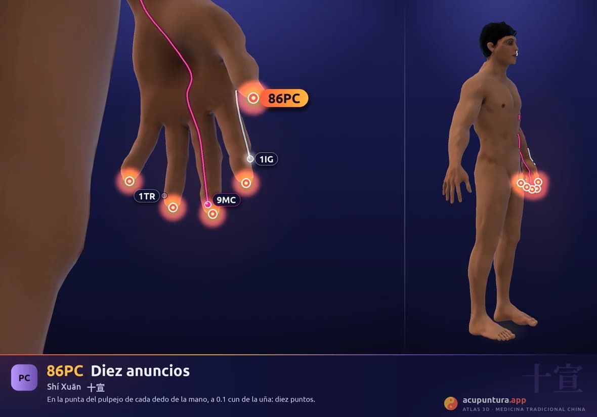 Localización del punto 86PC, Diez anuncios