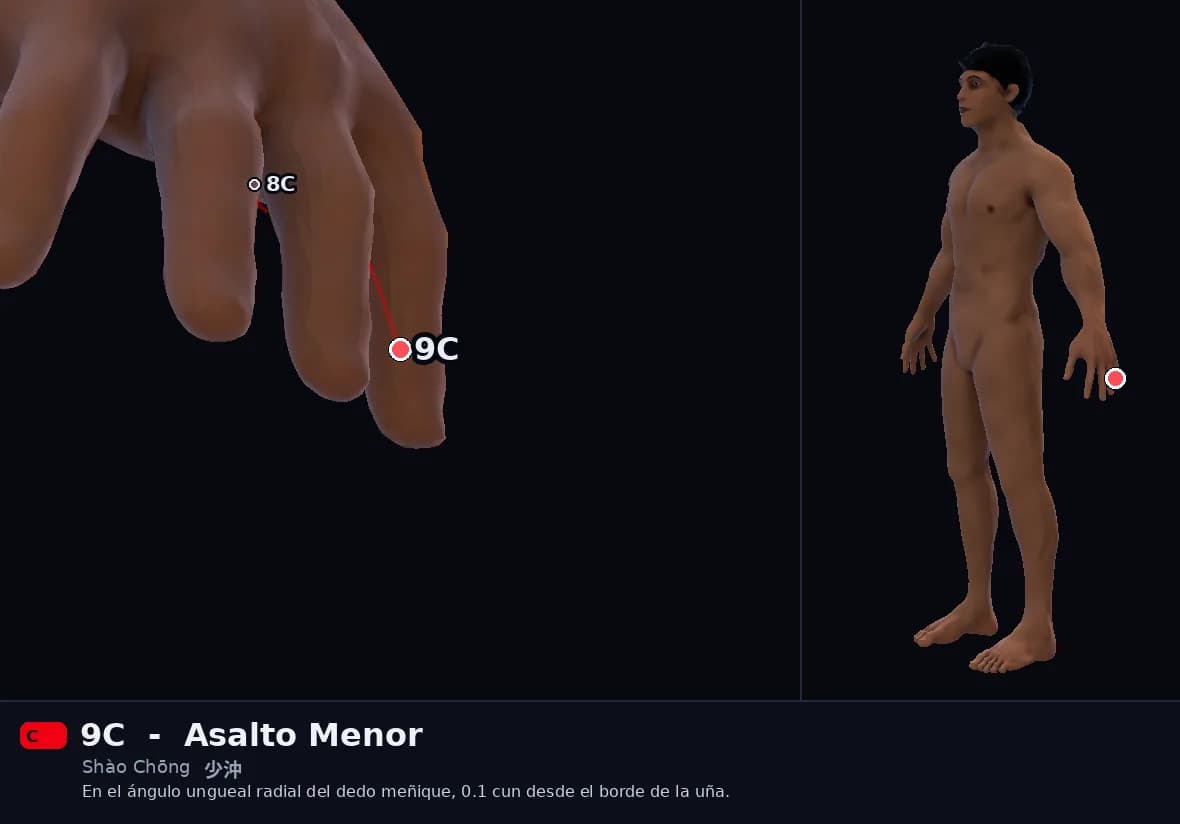 Localización del punto 9C, Asalto Menor
