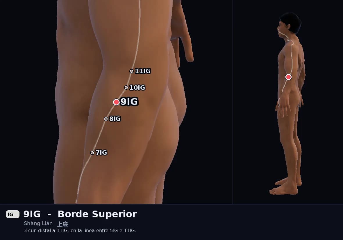 Localización del punto 9IG, Borde Superior