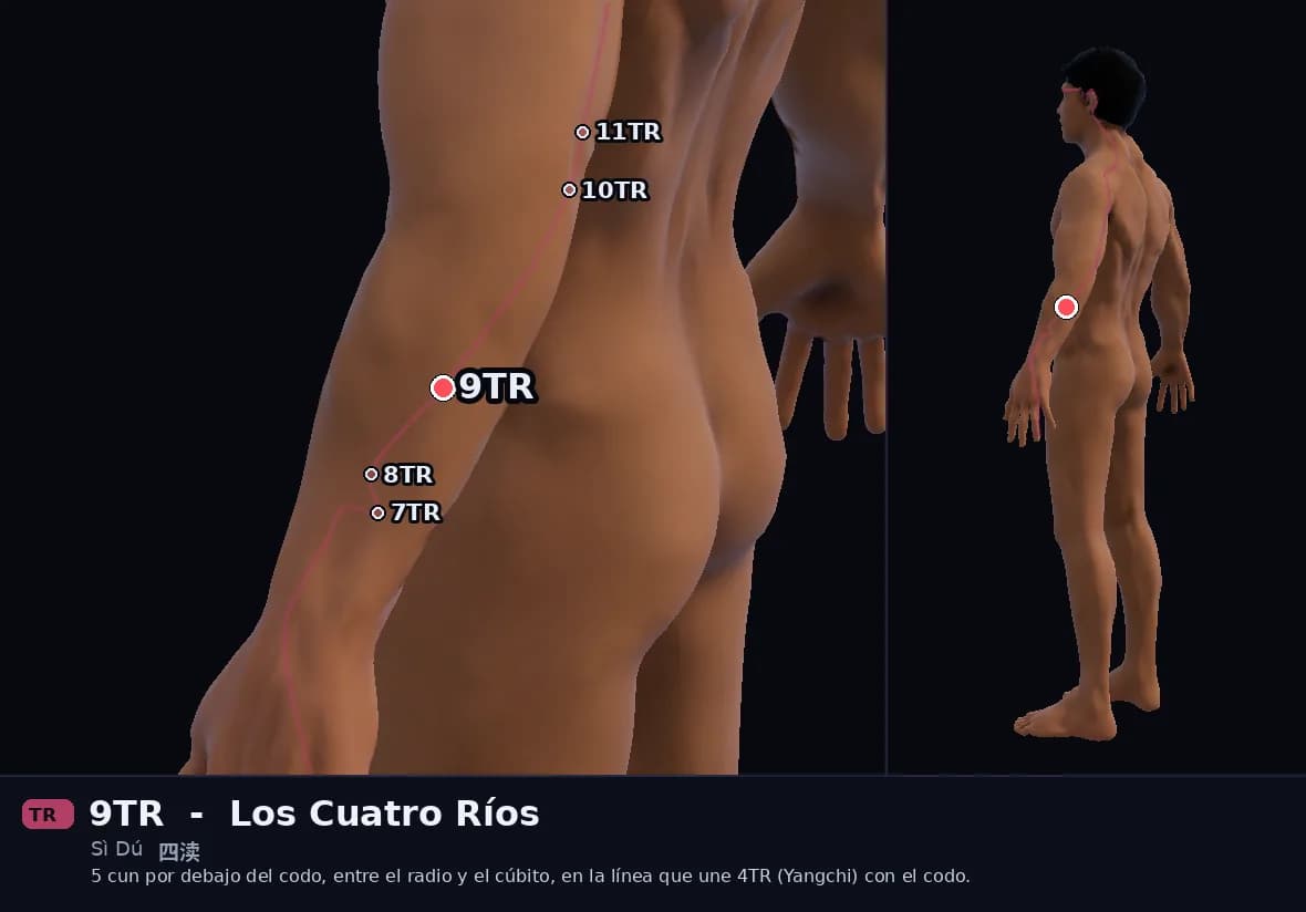Localización del punto 9TR, Cuatro Fosos