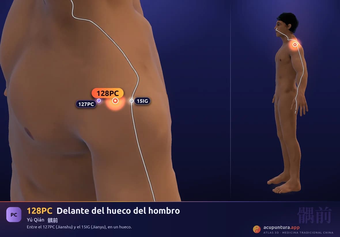 Localización del punto 128PC, Delante del hueco del hombro