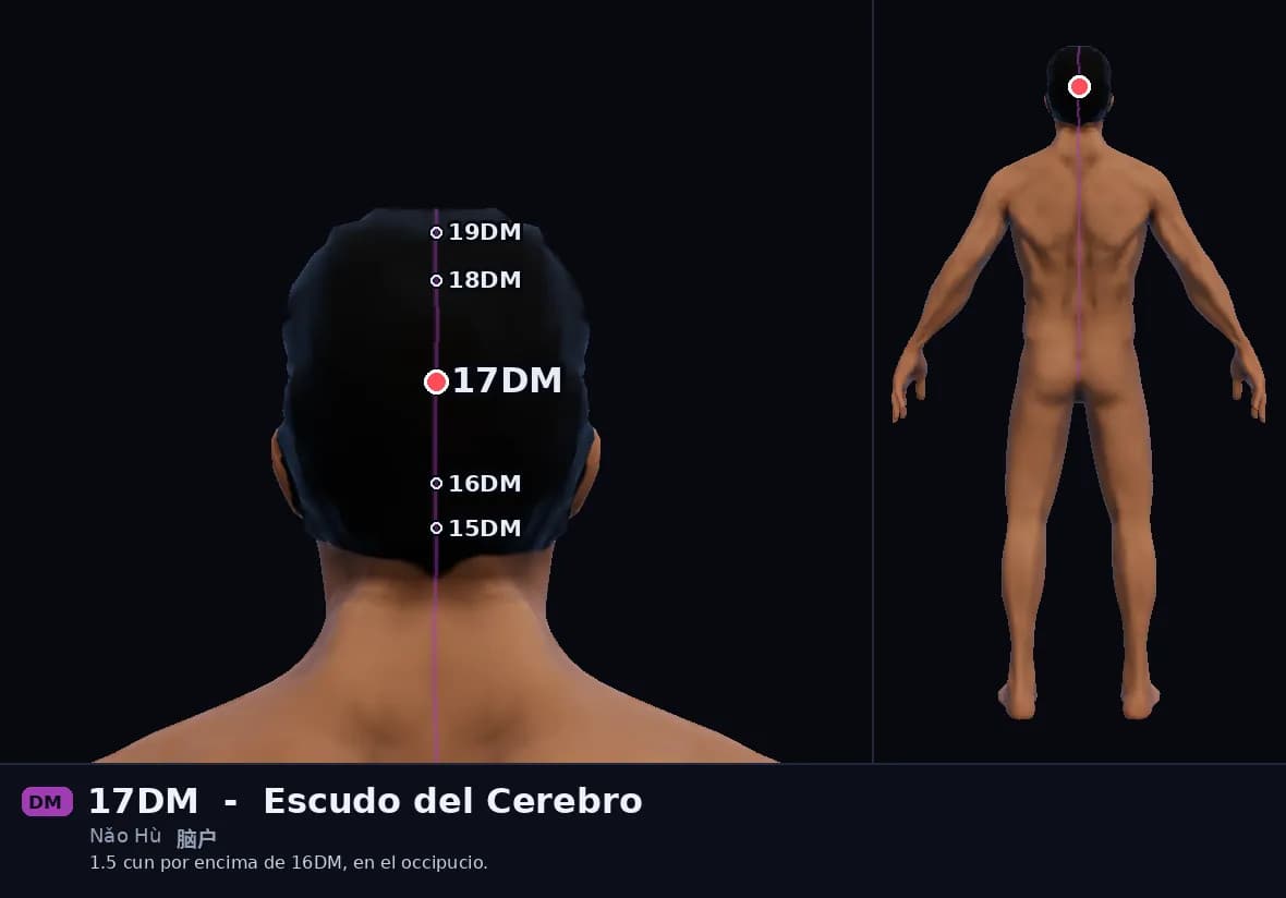 Localización del punto 17DM, Puerta del Cerebro
