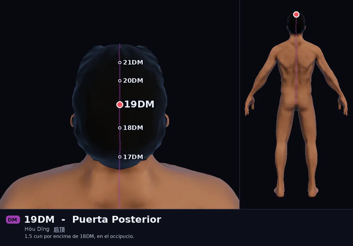 Localización del punto 19DM, Vértice Posterior