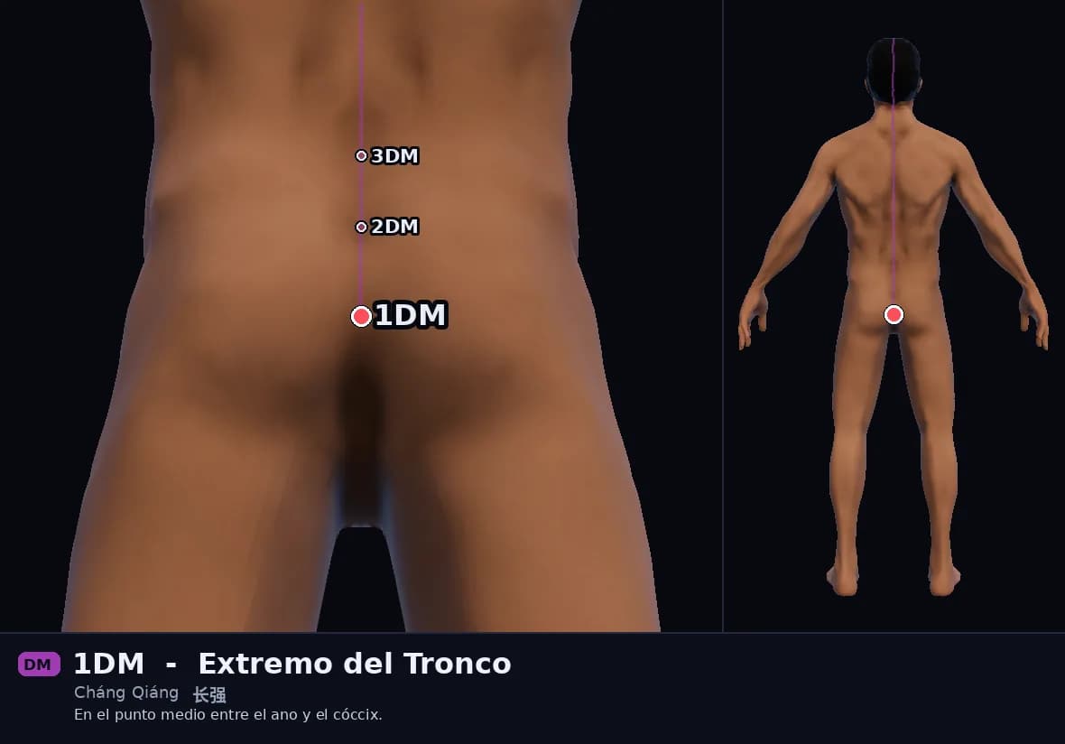 Localización del punto 1DM, Extremo del Tronco
