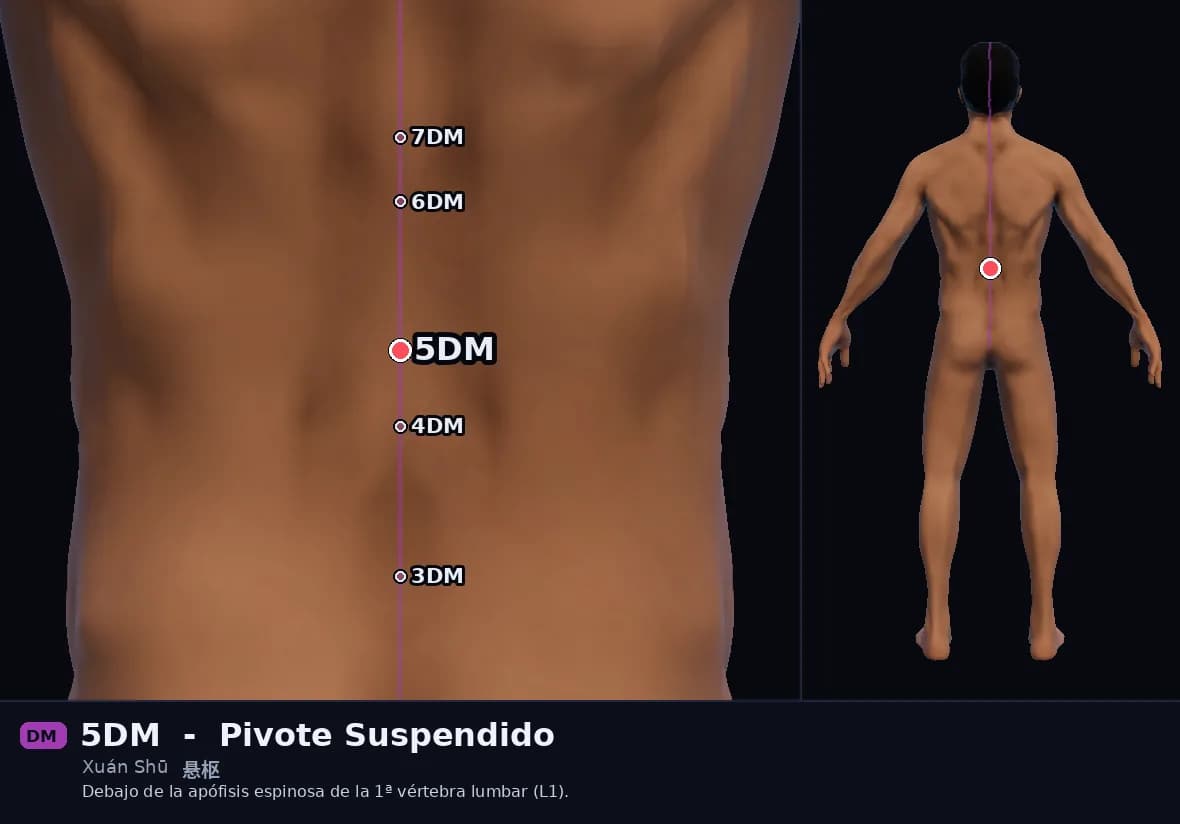 Localización del punto 5DM, Pivote Suspendido