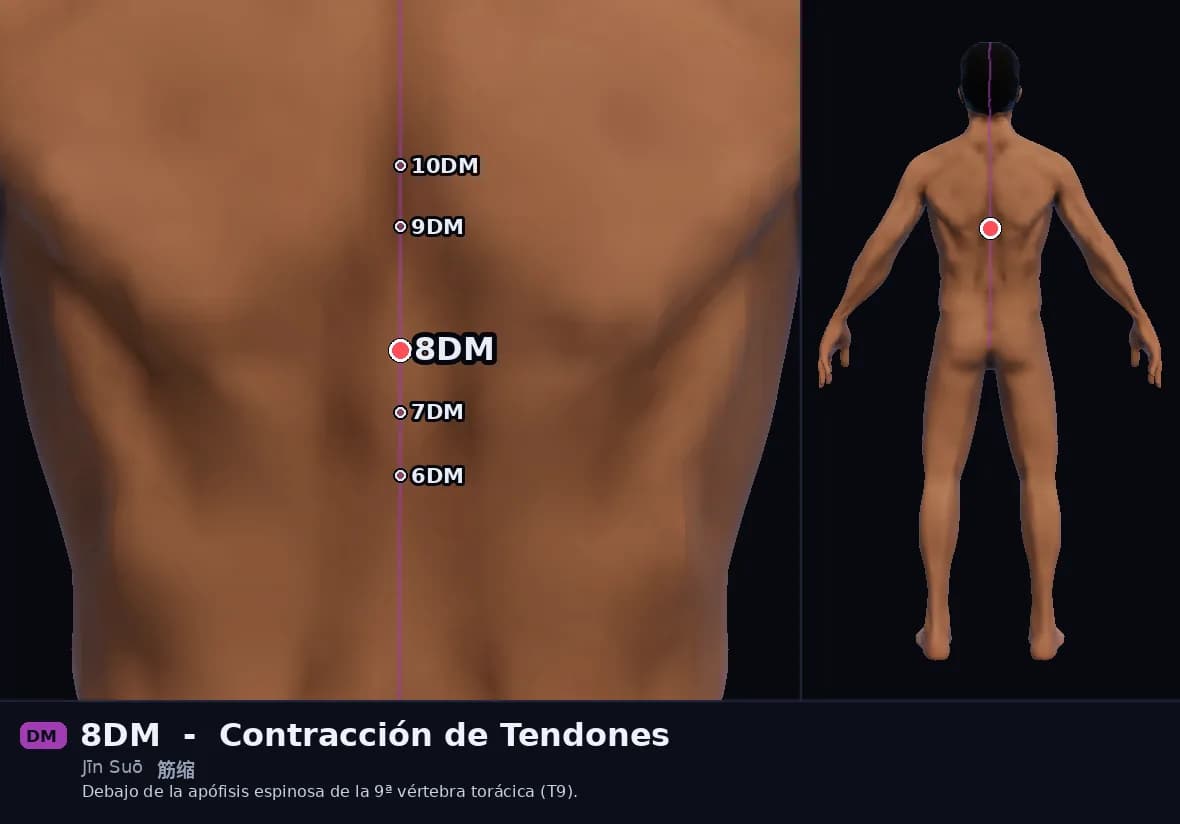 Localización del punto 8DM, Contracción de Tendones